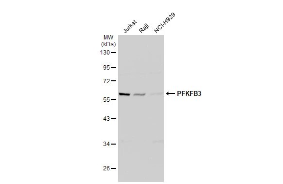 6 Phosphofructo 2 Kinase Antibody
