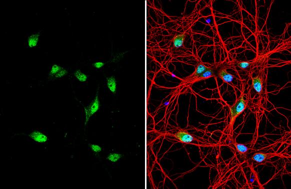Centaurin alpha 1 Antibody - BSA Free