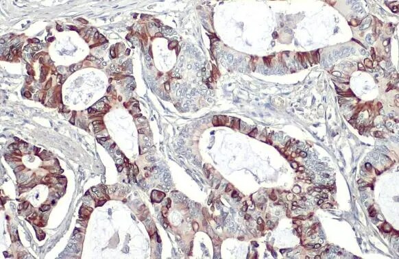 GPER/GPR30 Antibody