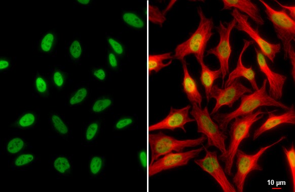 HDAC1 Antibody