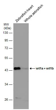 WT1 Antibody