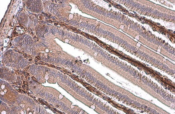 Vimentin Antibody