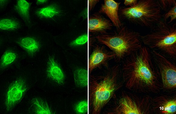 Vimentin Antibody