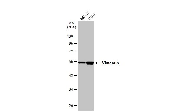 Vimentin Antibody