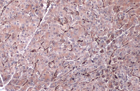 Vimentin Antibody