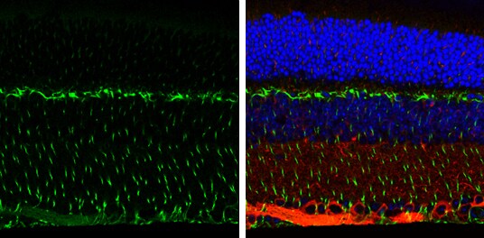 Vimentin Antibody