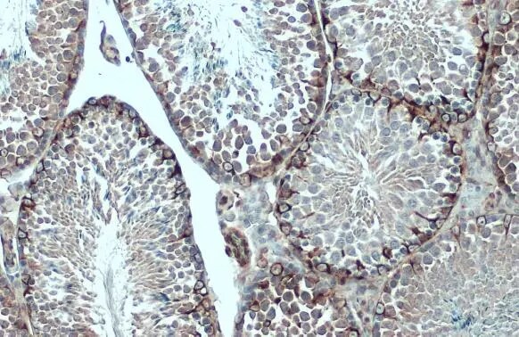 Vimentin Antibody