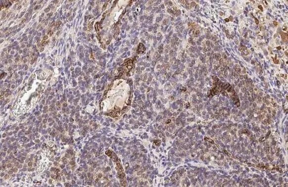 Vimentin Antibody