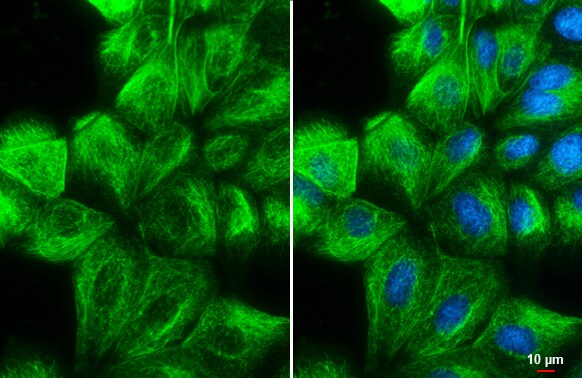 Vimentin Antibody