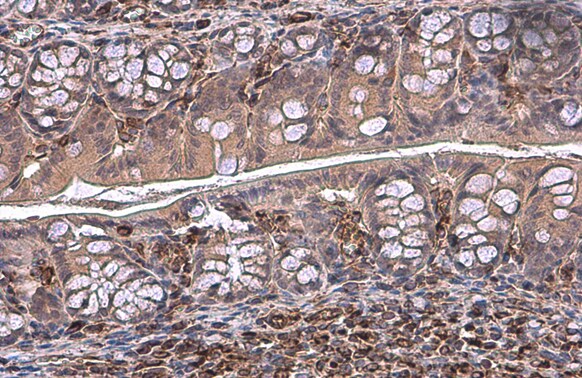 Vimentin Antibody