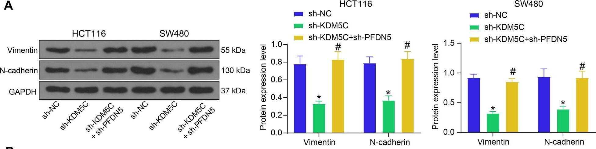 Vimentin Antibody