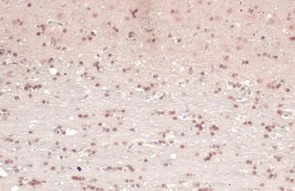 Acetylcholinesterase/ACHE Antibody