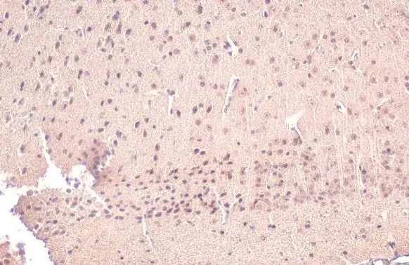 Acetylcholinesterase/ACHE Antibody