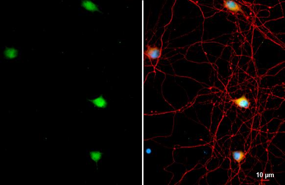 Acetylcholinesterase/ACHE Antibody - BSA Free