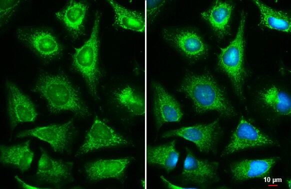 Fumarase Antibody