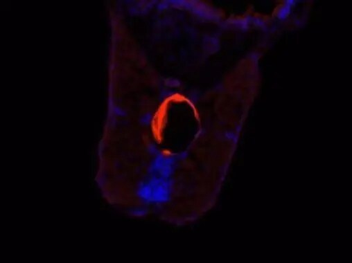 CCT5 Antibody