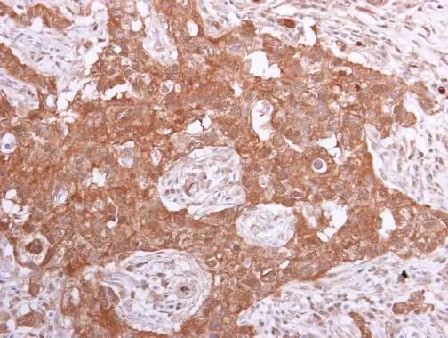 Inorganic Pyrophosphatase/PPA1 Antibody