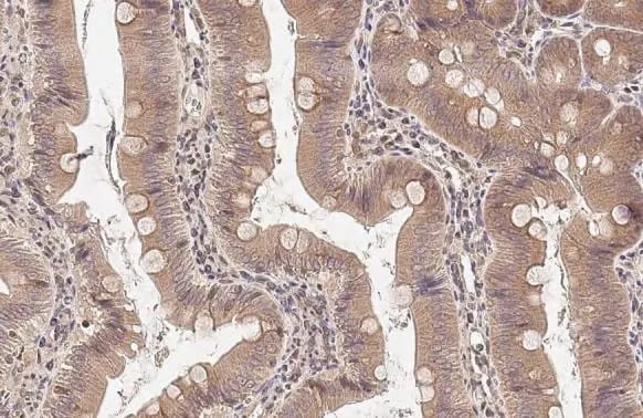 Natriuretic Peptide Receptor C Antibody