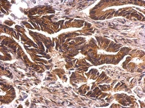 PKN2 Antibody