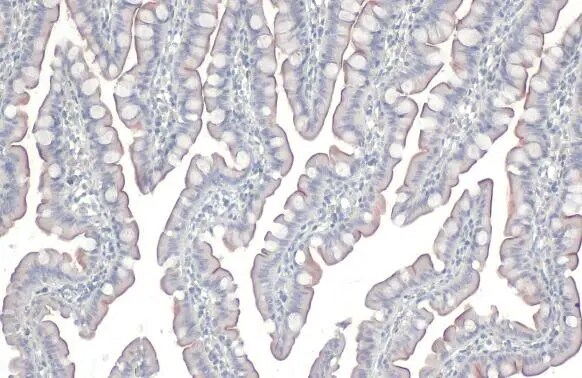 Fibronectin Antibody