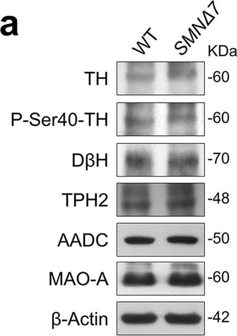 Dopamine beta-Hydroxylase Antibody