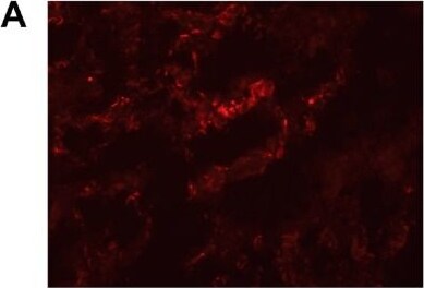 CXCL14/BRAK Antibody