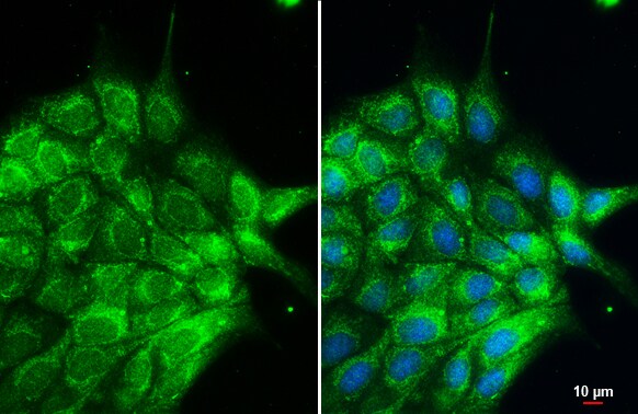 Cytokeratin 2 Antibody
