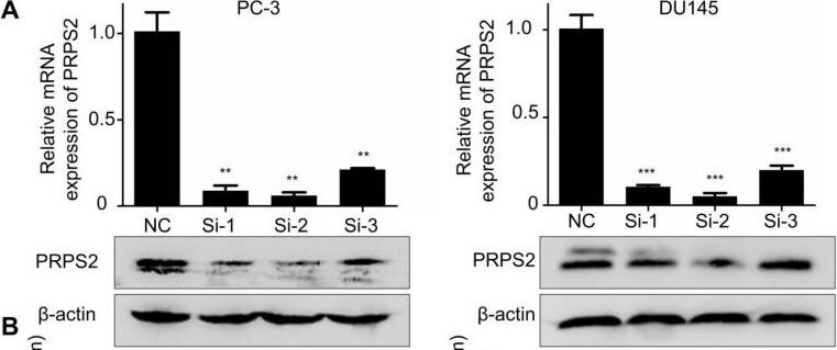 PRPS2 Antibody