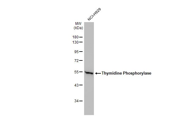PD-ECGF/Thymidine Phosphorylase Antibody
