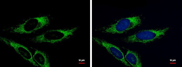 AK3L1 Antibody