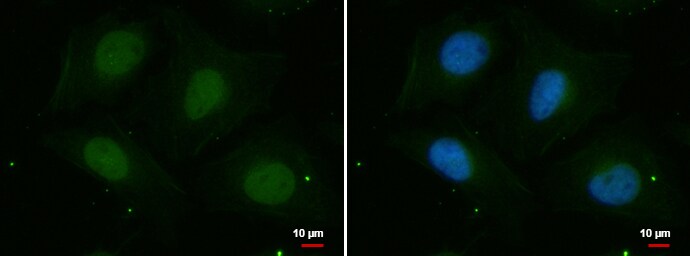 PSKH2 Antibody