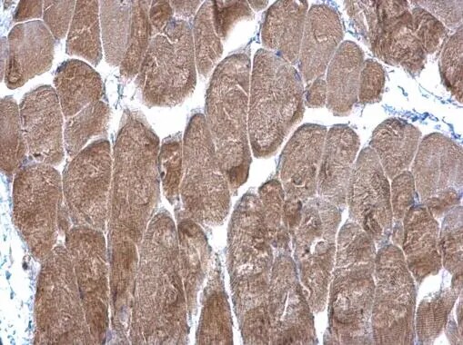 DPP3 Antibody