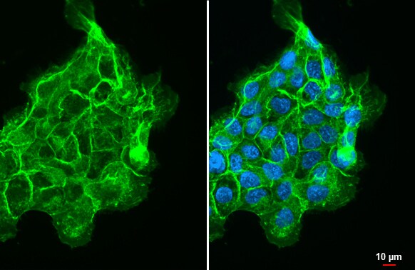 CD44 Antibody