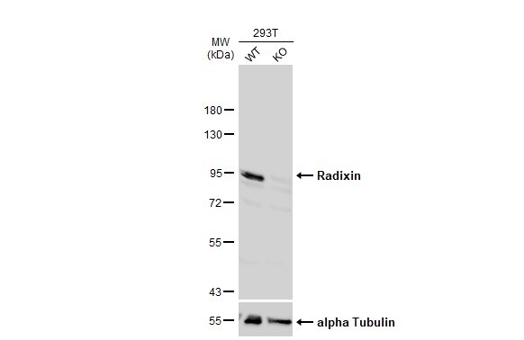 Radixin Antibody - BSA Free