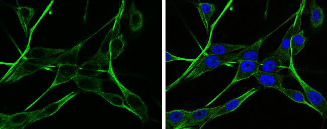 alpha-N-acetylglucosaminidase/NAGLU Antibody - BSA Free