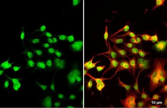 NKX2.5 Antibody
