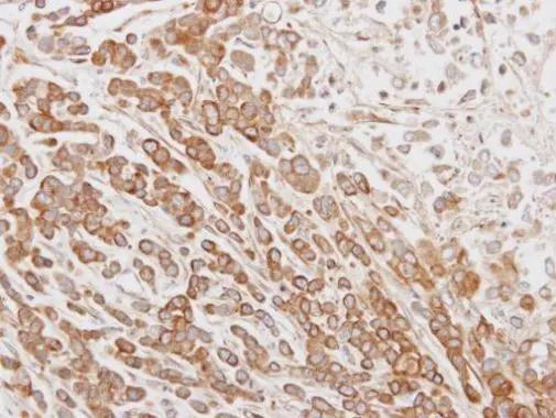 CABS1 Antibody - BSA Free
