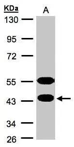CABS1 Antibody - BSA Free