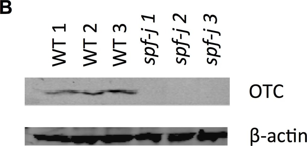 Ornithine Carbamoyltransferase Antibody