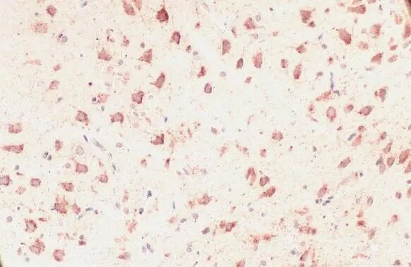 GRP75/HSPA9B/Mortalin Antibody