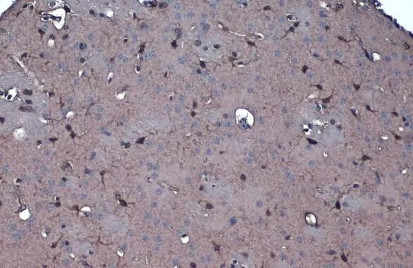 Isocitrate Dehydrogenase 1/IDH1 Antibody