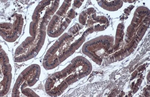 Isocitrate Dehydrogenase 1/IDH1 Antibody