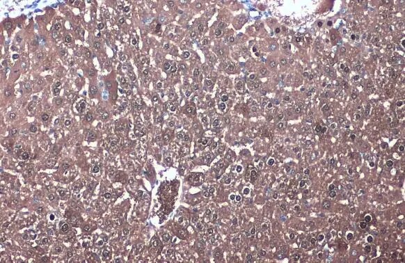 Isocitrate Dehydrogenase 1/IDH1 Antibody
