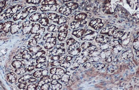 Isocitrate Dehydrogenase 1/IDH1 Antibody