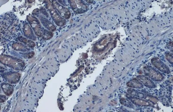 Isocitrate Dehydrogenase 1/IDH1 Antibody