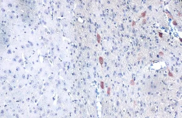 Proapoptotic Caspase Adaptor Protein Antibody
