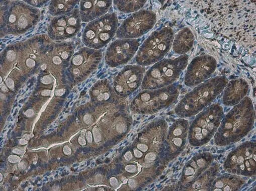 RRM2 Antibody