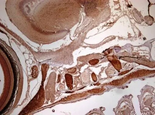 RRM2 Antibody