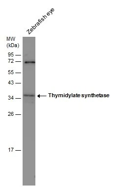 Thromboxane synthase Antibody