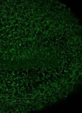ALDH2 Antibody